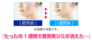 取り 方 顔 シミ の の